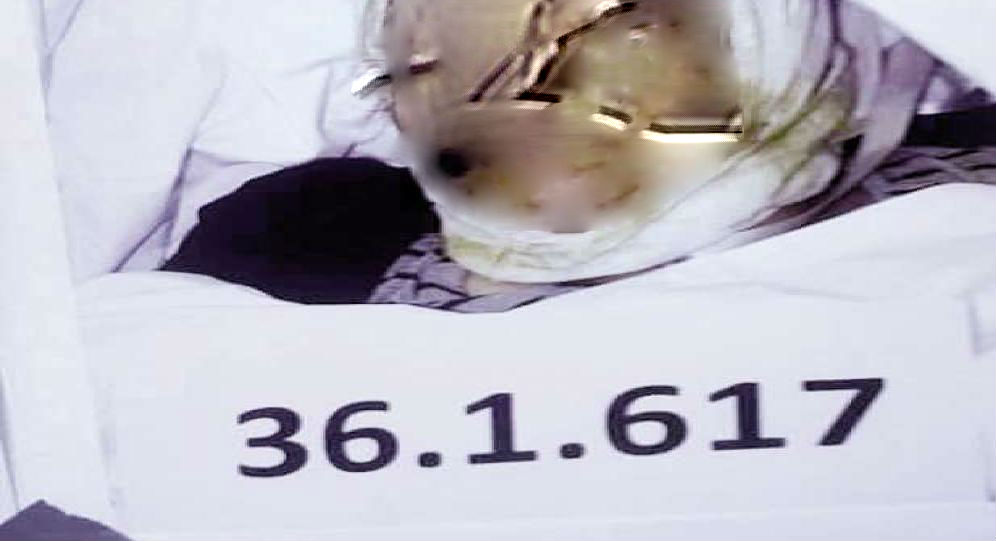 السعودية تنفى (الدفن الجماعى) لـ600 جثة