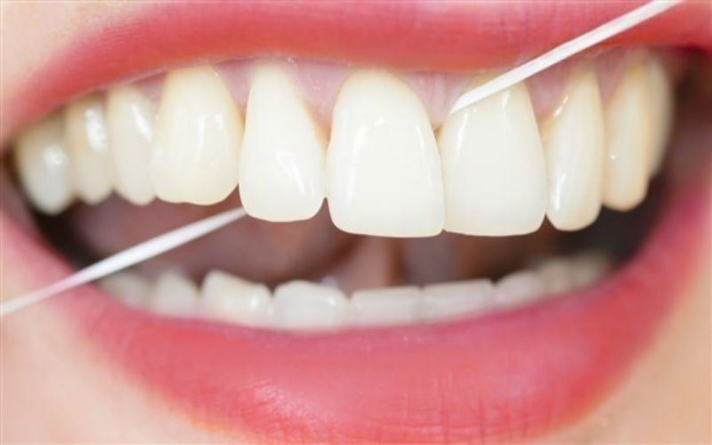 ما سبب بياض لون اللثة؟