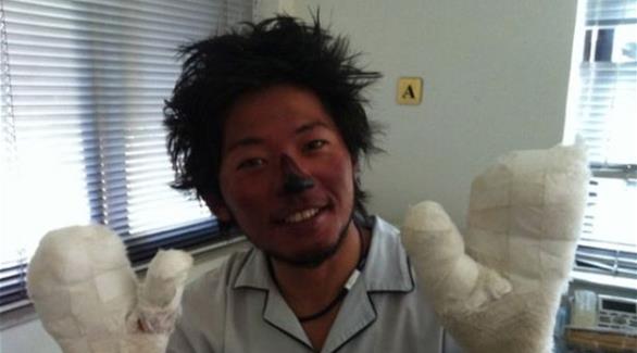 ياباني يحاول تسلق جبل إفرست بإصبع