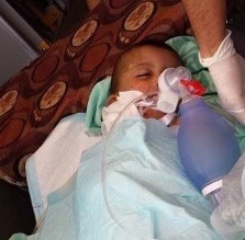 استشهاد رضيع حرقا واصابة عائلته في
