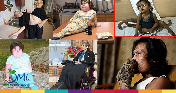 أغرب 20 حالة طبية في العصر