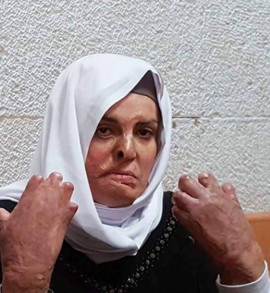 إسراء الجعابيص.. أسيرة فلسطينية تهز قلوب