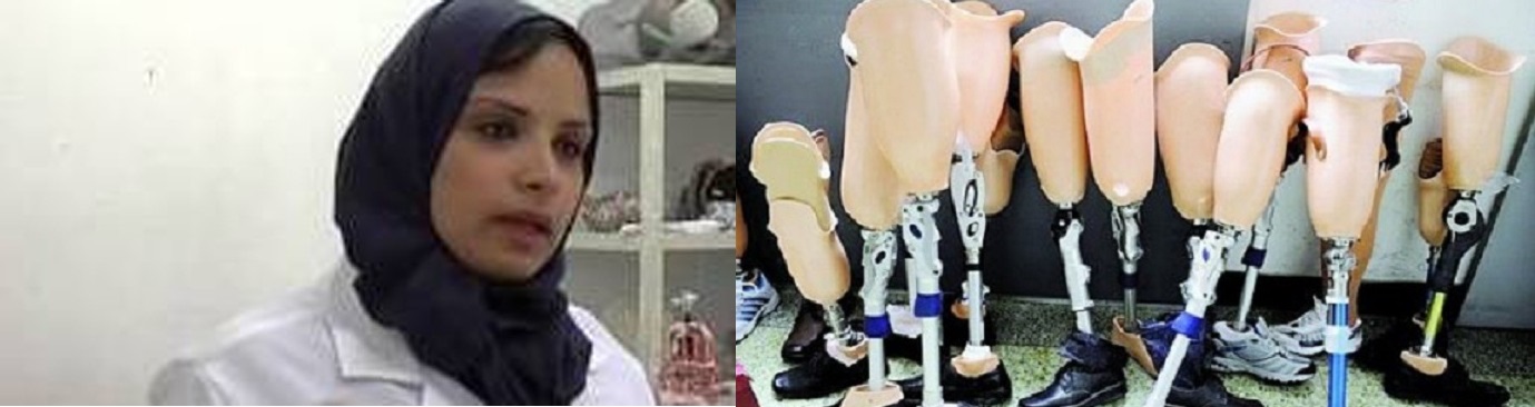 لنا كرنز.. غزية تصنع وتركب الأطراف