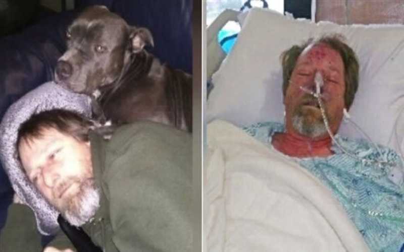 يخسر قدميه بسبب لعق الكلب له