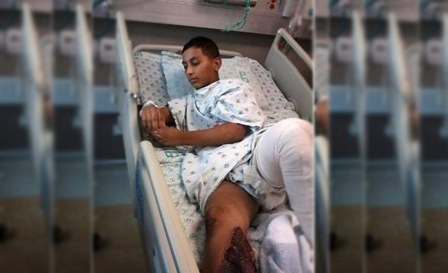 الطفل الاسير المعطي مهدد ببتر قدمه