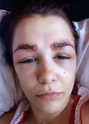 شابة اجتهدت في تعديل حواجبها فتشوه