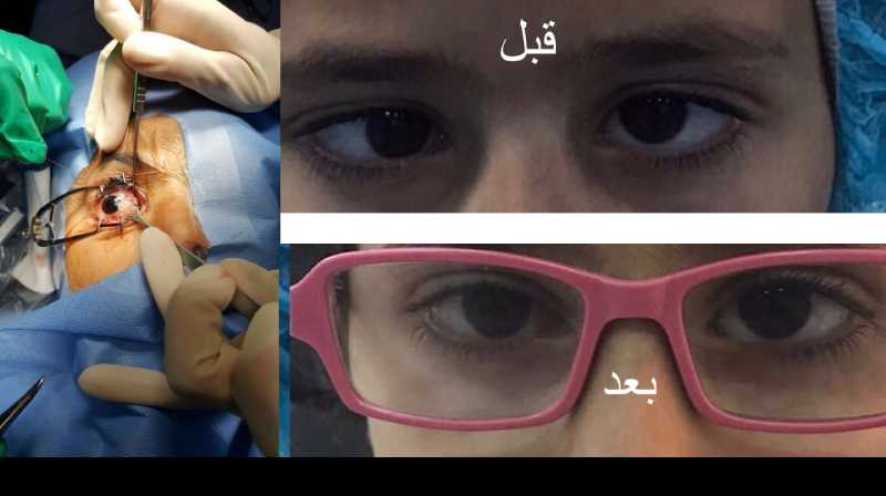 تقنية حديثة بمستشفى الملك المؤسس لإصلاح