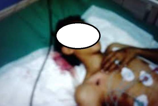 طفل يصيب شقيقه برصاصة خطأ في