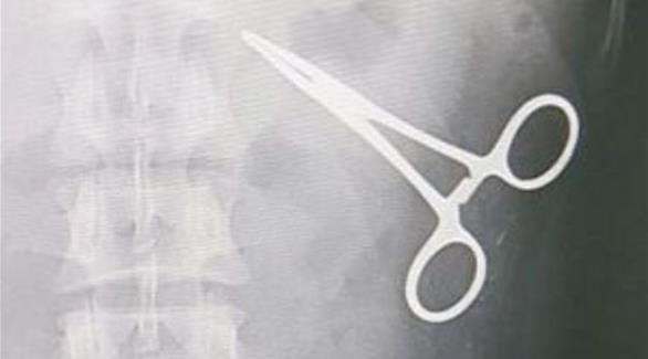 آلة كشف المعادن تعثر على مقص