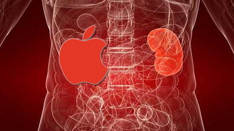 صيني يبيع كليته ليشتري أيفون 6