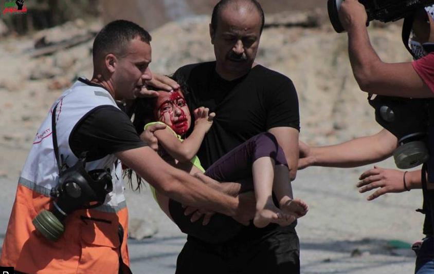 إصابة مدير شرطة نابلس وطفلته والعشرات