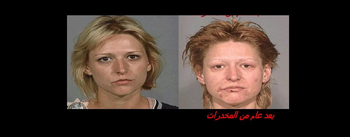 الفتاة مدمنة مخدرات .. ما الحل؟