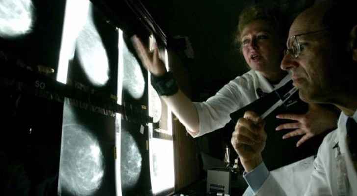 ثورة طبية .. اكتشاف الإصابة بالسرطان