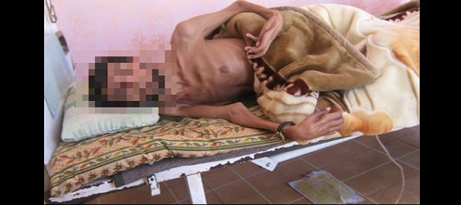 محمد السليمات .. شلل رباعي يقعده