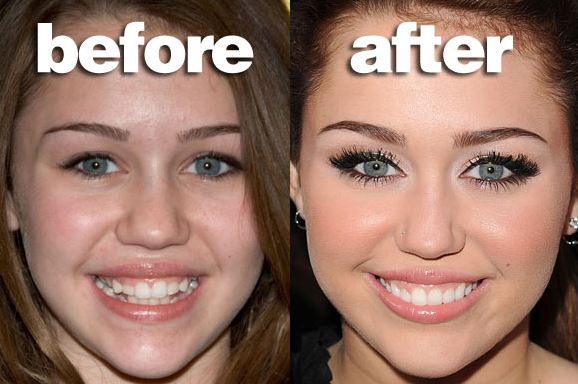 هوس التجميل لملاحقة الابتسامات الساحرة