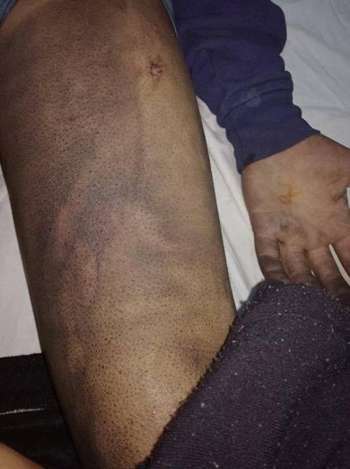 عمان.. إاصابة فتى بجروح و حروق