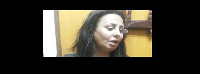 بطلة كليب (سيب إيدى) لوسائل الإعلام: