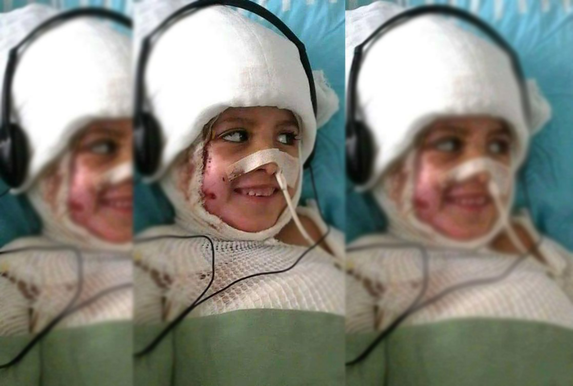 الطفل أحمد دوابشة ما زال يستطيع