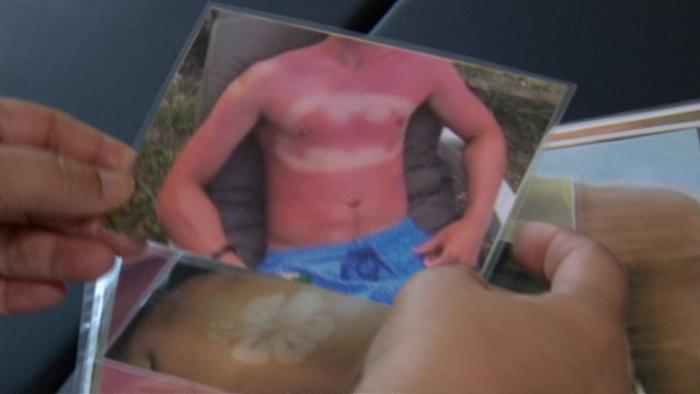 وشم الشمس.. صيحة جديدة قد تنتهي