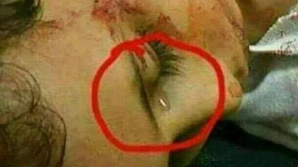 طفل فارق الحياة ودموعه على خده