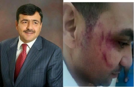 شقيق النائب الشوابكة يوضح حادثة الإعتداء