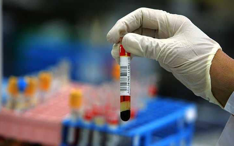 الحكومة توافق على تغطية نفقات علاج