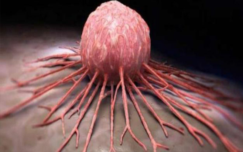 سرطانا ’القولون والمستقيم‘ الأكثر انتشارا في