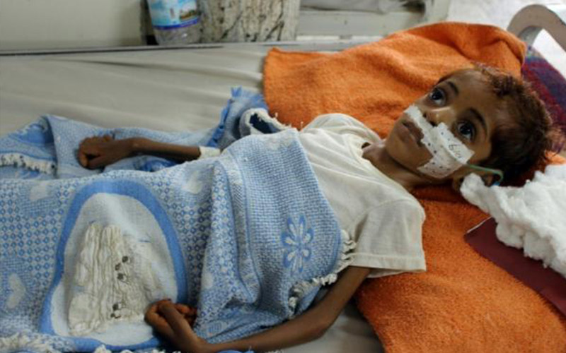 الأمم المتحدة تحذر من مجاعة قد