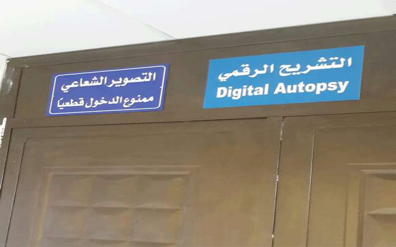 اجهاض عمل جهاز التشريح الرقمي يثير