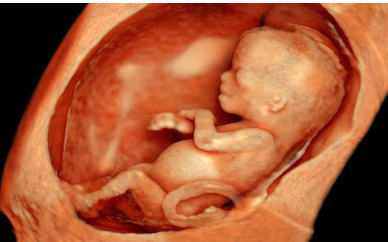 مستشفى البشير: تقصير الطبيب ادى الى