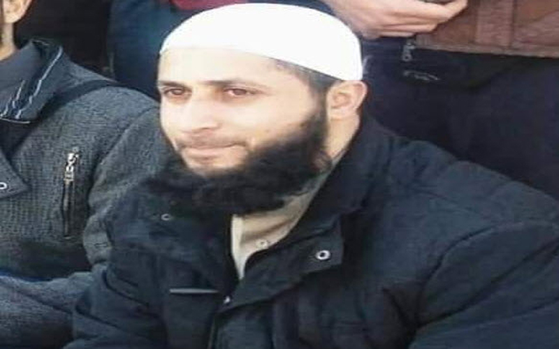 الضمان : دراسه لشمول اسيد اللوزي