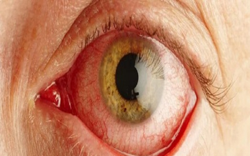 خطأ طبي باحد المستشفيات الخاصة يتسبب