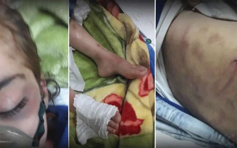 وفاة طفلة عراقية عذبتها زوجة أبيها