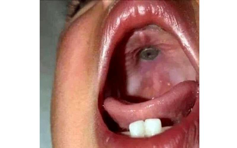 مدير مستشفى الكرك الحكومي يوضح حقيقة