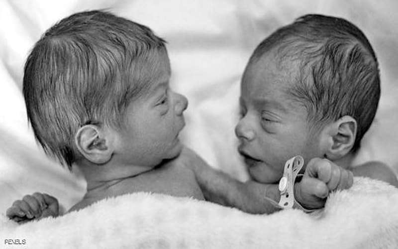 حالة نادرة.. امرأة تلد توأمين من
