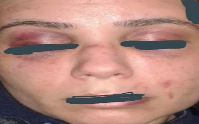 الزرقاء.. زوج يهين زوجته ويربطها بالجنازير