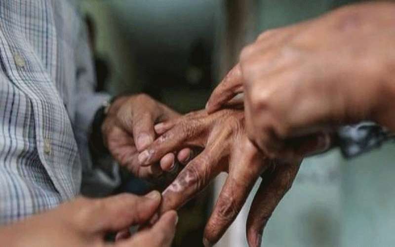 الصحة: لا إصابات بالجذام والمملكة خالية