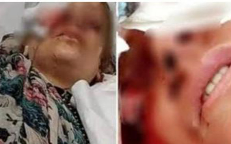 ’كانوا مترددين وخائفين‘.. تفاصيل لقاء سيدة