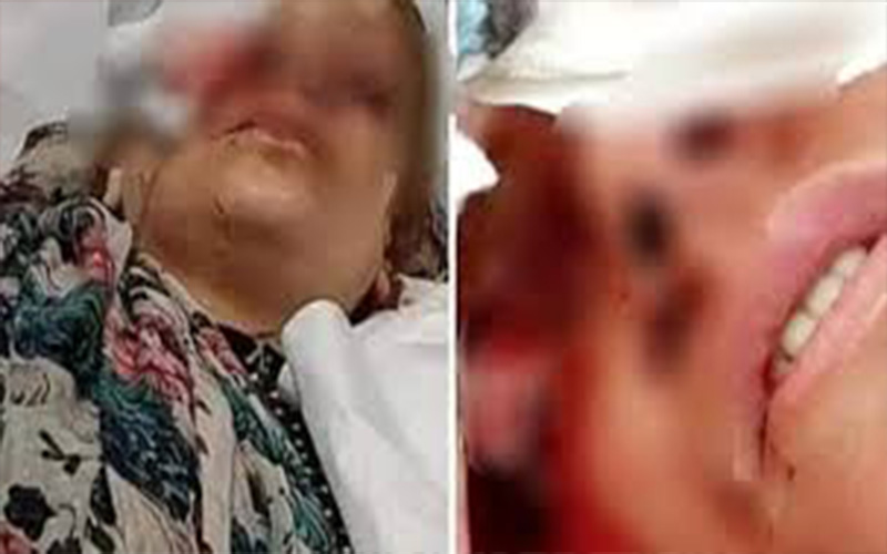 الجنايات توجه تهمة الشروع بالقتل للزوج