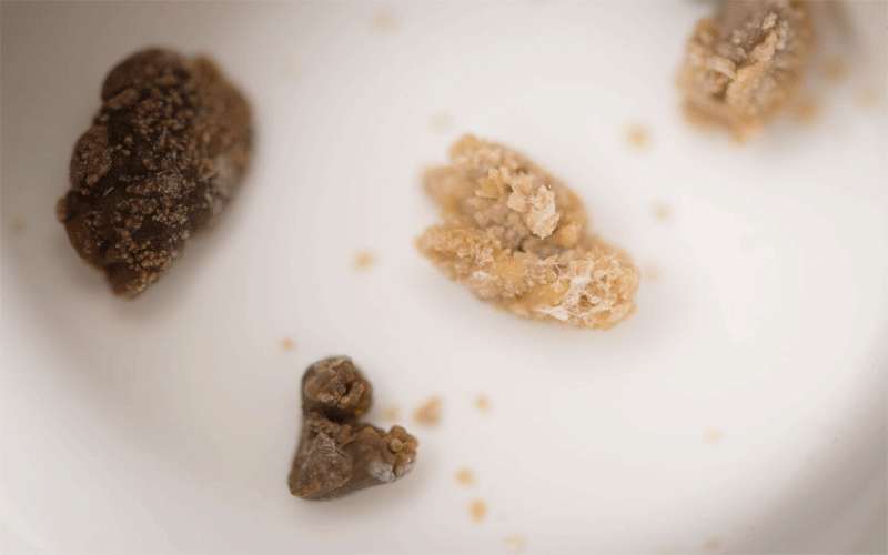 الغذاء والدواء: مستحضر Clearstone لم يسجل