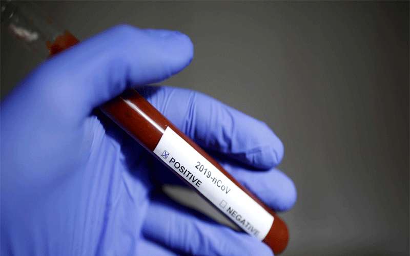 فرق الاستقصاء الوبائي تجري 297 عينة