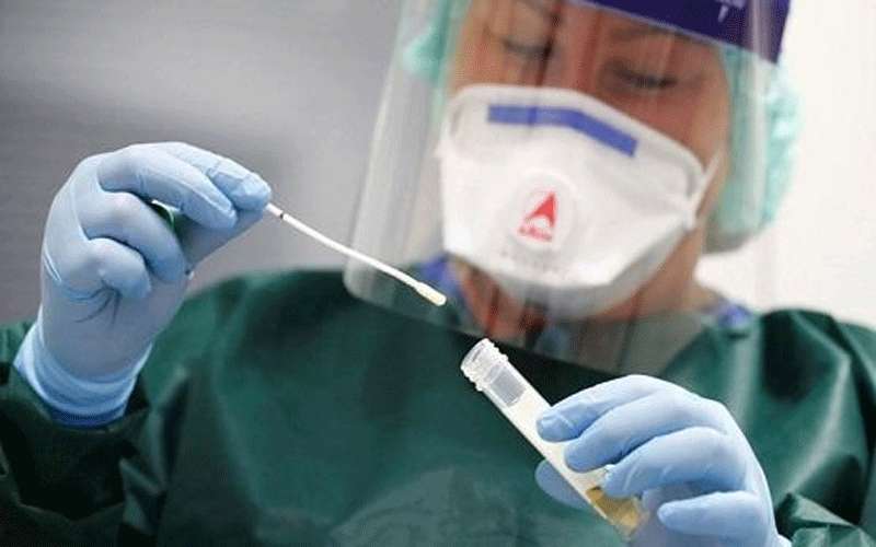 تطوير شرائح فحص كورونا أردنية