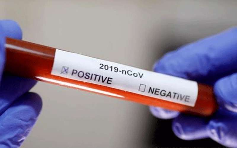 عبيدات يوضح مدة تحديد مصدر الاصابة