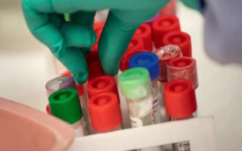 هياجنة: PCR الفحص الوحيد المعتمد لكورونا