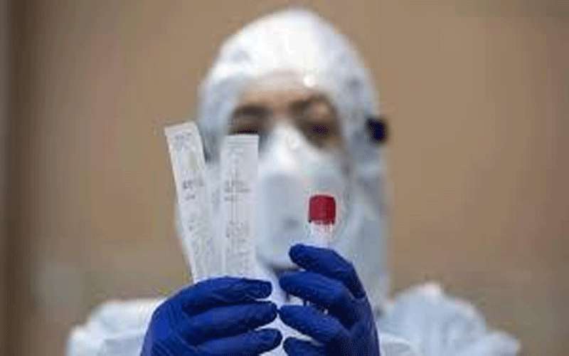 نتائج سلبية ل 300 عينة من