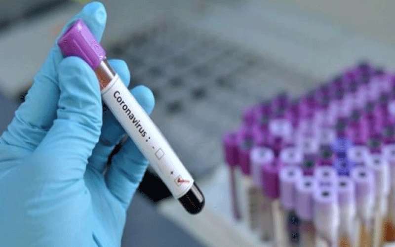 نتائج فحوصات 10 عينات من مخالطين