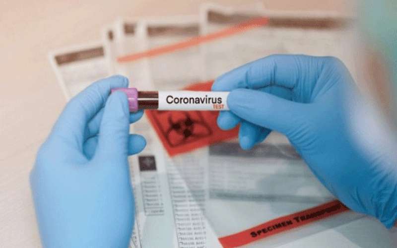 نتائج سلبية لفحوصات الكوادر الطبية والتمريضية