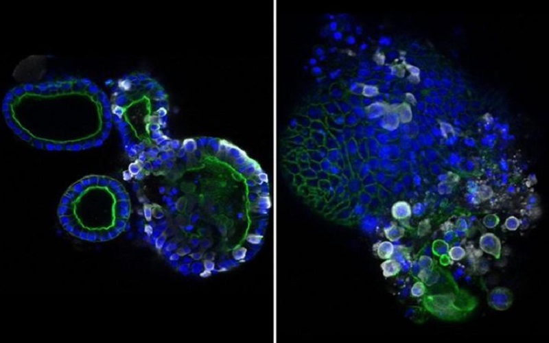 أوضح صورة لفيروس كورونا