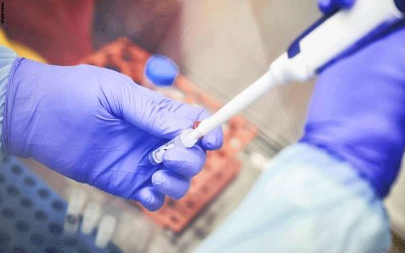 فحوصات كورونا لـ 1150 عينة جديدة