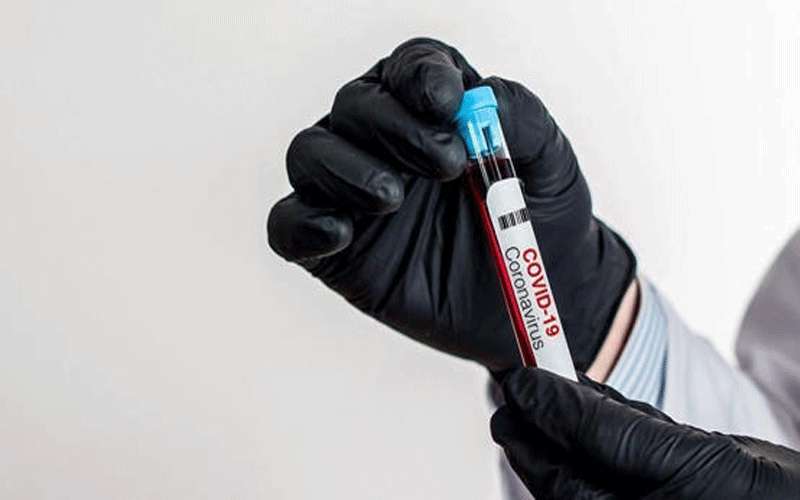 نتائج سلبية لـ3 مخالطين لسائق الشاحنة